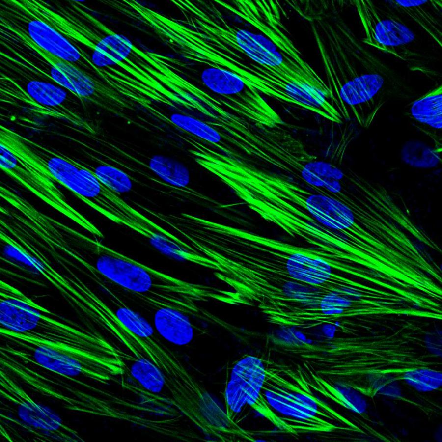 一步法 BF™ 488 鬼笔环肽/Nucleiblue 双标染色试剂盒